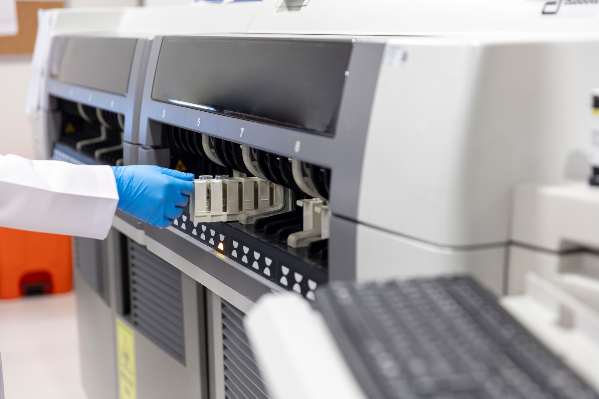 Biochemical analysis of blood, COVID-19. Sample analysis in a large laboratory. Male hand puts samples into analysis machine. Hospital lab.