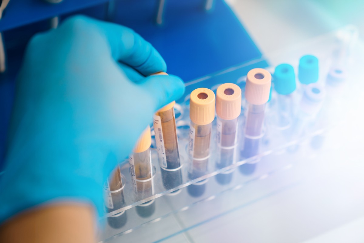 Labador Testing Comprehensive Testing Services at Adventus Labs USA